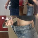 부산 서면지방분해주사 팔뚝, 부유방, 하복부 5회차 [5주간 실제 나의 후기]