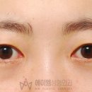 에이엠성형외과의원 네이버블로그