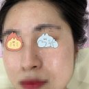 일라에스테틱 이미지