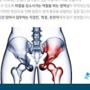 엉덩이가 아파요 통증 원인 이미지