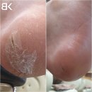 BK민방경네일