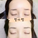 까진눈썹