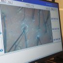 모코드두피탈모센터 이미지