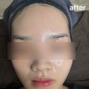 원주 거꾸로가는시간 따뚜점 스킨플래닝 후기✨