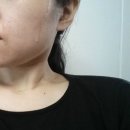 메디타임네오 보탈리늄 앰플 / 바르는 보톡스로 집에서도 전문 주름케어