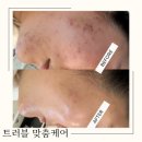 포미샵 이미지