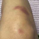 (사)사랑해밥차 | 너무 추워서 고슴도치 낳음