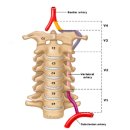 [경험담] 척추 종양 (경추 C3~5) [ 경험담 ] 05. 척추 종양이 압박할 수 있는 추골동맥(척추동맥)에 대하여 이미지