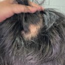 이마트24 광주평동산단점 | 원형 탈모라니_!! ㅠㅜ 경기 광주 경안동 &#34;스파오라 스칼프&#34; 방문 후기 / 탈모케어 / 헤드 스파 /두피...