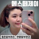 3제이3에이치 | 평촌피부관리 받고 속건조피부 피부장벽 복구 리셋게이트 찐후기 에스떼제이 안양평촌점