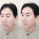에스이엠