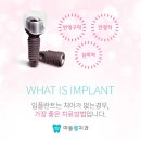 노원-상계-2211 | 상계역임플란트 신중하게 해야되는 이유