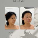 빛나리움에스테틱 | 서산피부관리 빛나리움에스테틱 효과 확실한 탄력 근막관리 만족후기