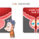티엘씨 이미지