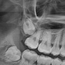 더봄치과교정과치과의원 이미지