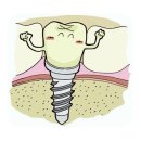 (주)이디임플란트 네이버블로그