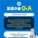 진성레이져 이미지