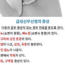 급성 신우신염 증상 원인 치료 이미지