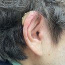 스타키보청기 안동점 이미지