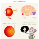바른눈안경 이미지