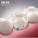 서울사랑니안녕치과의원 이미지