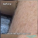클릭천사 | "탈모약 먹고 얼굴 털만 쑥쑥? 😱 당황하지 말고 클릭! (리얼 후기)"