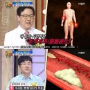 콜레스테롤 수치 높은 이유와 개선방법! 이미지