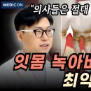 잇몸병 걱정 이걸로 끝내세요. 제발 이 습관들은 꼭 고치세요. 이미지