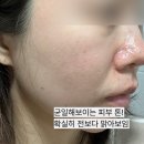 수 코스메틱 | 오월의아침 코스메틱 비타민C앰플 민감피부 사용 후기