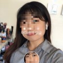 엘라고A 이미지