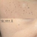 깨순이뷰티 이미지