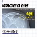 애니핏짐 | 군산 헬스 애니핏짐에서 어깨 석회성 건염 재활하기