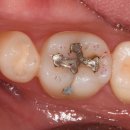 메인치과기공소 이미지