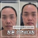 창원 안면비대칭 고민이던 고모, 고성 오늘뷰티 1:1 맞춤관리 후기