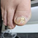 고민은네일해 | 대구 서구 네일 내일도네일해 고민 있었던 발 케어 후기