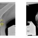 홀가분정형외과의원 이미지