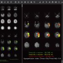 제이엘케이 이미지
