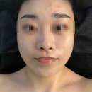 와랑와랑 | 중랑구 묵동 피부관리 와랑와랑뷰티헤드스파 후기