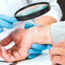 누리한방병원 | 내 피부 고민, 한방으로 해결했어요! 리얼 후기 들어볼래요?