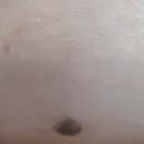 몽벨리아성형외과의원 이미지