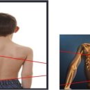 척추/골반/재활[허리(목) 디스크, 척추 협착증 & 측만증, 좌골신경통...] & 보디빌딩(Body building)[몸짱 & 탄력있는 몸매] 1:1 맞춤 운동 전문[예약제 운영] 이미지