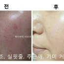 제이부띠 이미지