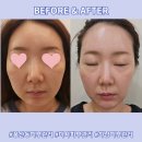 미사메디 | [풍산동피부관리] <그레이스 미사 피부관리> 탄력 리프팅관리 후기