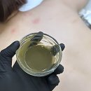 더진솔한주유소 | 충주등드름 고민 끝! 드디어 인생 피부 만난 찐 후기