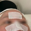 부평일번가 | 부평 피부관리 데자뷰메디스킨 아쿠아필 후기