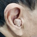 세종보청기 이미지