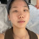 뽀송 | 효자동 트러블 맞춤 관리로 장벽 개선된 뽀송에스테틱 후기