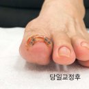 골목살롱 네일