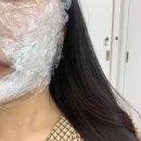 강남 라렌의원에서 리쥬란힐러 맞은 후기(통증,엠보,비용,효과 등)/ 아름닥터