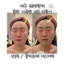 평화시장(관리실) | 대구 웨딩관리, 물광피부 만들기 | 신암동 / 끌라르떼 에스테틱